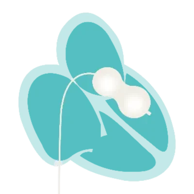 Conjunto de Cateter de Balão para PBMV